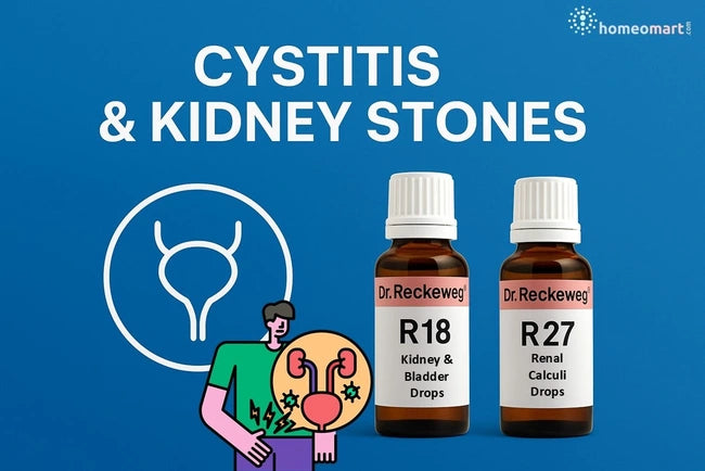 homeopathy relief medicines R18 & R27 for cystitis with kidney stones 