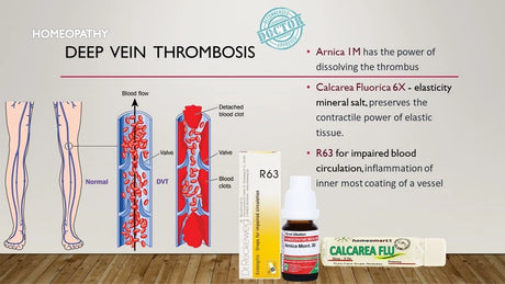 Homeopathy treatment for deep vein thrombosis with illustrations and product display.