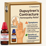 Homeopathy treatment package for Dupuytren's contracture with bottles and packaging on a beige background