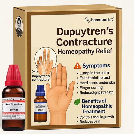 Homeopathy treatment package for Dupuytren's contracture with bottles and packaging on a beige background