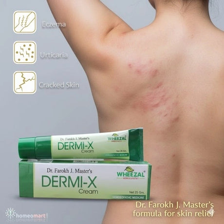 DERMI-X Cream packaging with a person showing Urticaria skin issues on a gray background