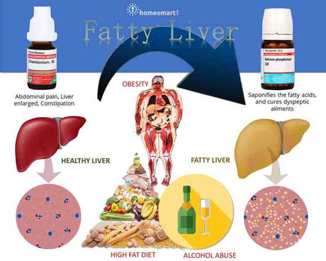 How to reduce fatty liver quickly