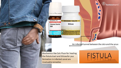 Two bottles of biochemc tablets with a diagram of a fistula and a person wearing gray pants.