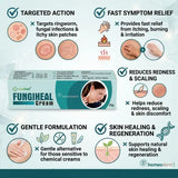 zinc antifungal cream, camphor itching relief, fungal rash treatment, skin infection cream, homeopathic skin care, ringworm itching solution, external antifungal cream