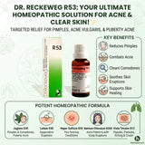Dr Reckeweg R53 ingredients and uses, Dr Reckeweg, R53, acne, acne vulgaris, pimples, acne pimples, teenage acne, puberty acne, back acne, facial acne, comedones, pustules, papules, suppurative skin, eczema, dermatitis, skin eruptions, homeopathic acne drops, homeopathic skin medicine, Reckeweg remedies, German homeopathy, 22 ml, Juglans, Hepar Sulfuris, Ledum, Viola Tricolor, Natrium Chloratum, acne homeopathy