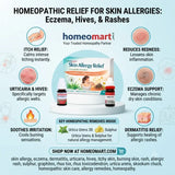 skin allergy remedy, eczema relief, dermatitis medicine, urticaria treatment, hives OTC med, itchy skin natural relief, burning skin, rash, allergic rash, sulphur, graphites, rhus tox, rhus toxicodendron, urtica urens, skookum chuck, homeopathic skin care, skin remedies, itching relief, chronic eczema, natural allergy support, allergy remedies, homeopathy,