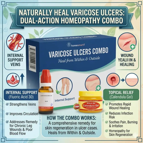 varicose ulcer homeopathic medicine uses, fluoric acid 30 benefits in varicose veins, calendula gel wound healing for varicose, varicose veins homeopathy combo benefits