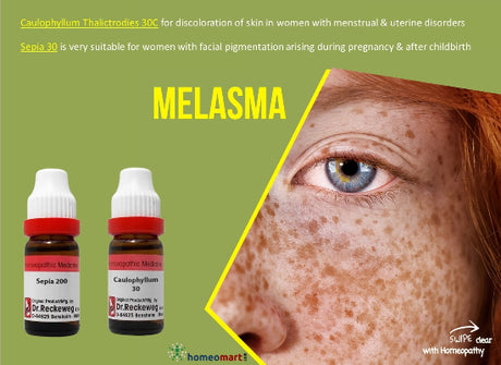 doctor-recommended homeopathy for melasma after pregnancy treatment