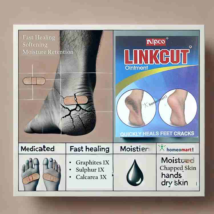 Dry Skin Best Product For Cracked Heels SA Renewing Foot Cream Dry