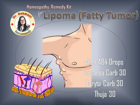 Dr. Rukmani recommended lipoma homeopathic medicine kit