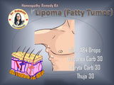 Dr. Rukmani recommended lipoma homeopathic medicine kit