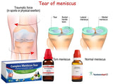 homeopathy for meniscus tear, homeopathic medicine for knee injury, meniscus injury remedies, sports injury homeopathy, knee ligament homeopathy, homeopathy for knee swelling, joint pain homeopathy