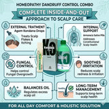 homeopathy, dandruff medicine homeopathy, dandruff flakes treatment, natural dandruff remedy, homeopathic scalp treatment, dandruff relief combo, best homeopathy for dandruff, dandruff combo pack