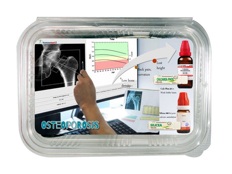 Osteoporosis homeopathic medicines by indications