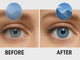 vidoe showing blur dim vision and a  homeopathy kit box followed by clear vision image 