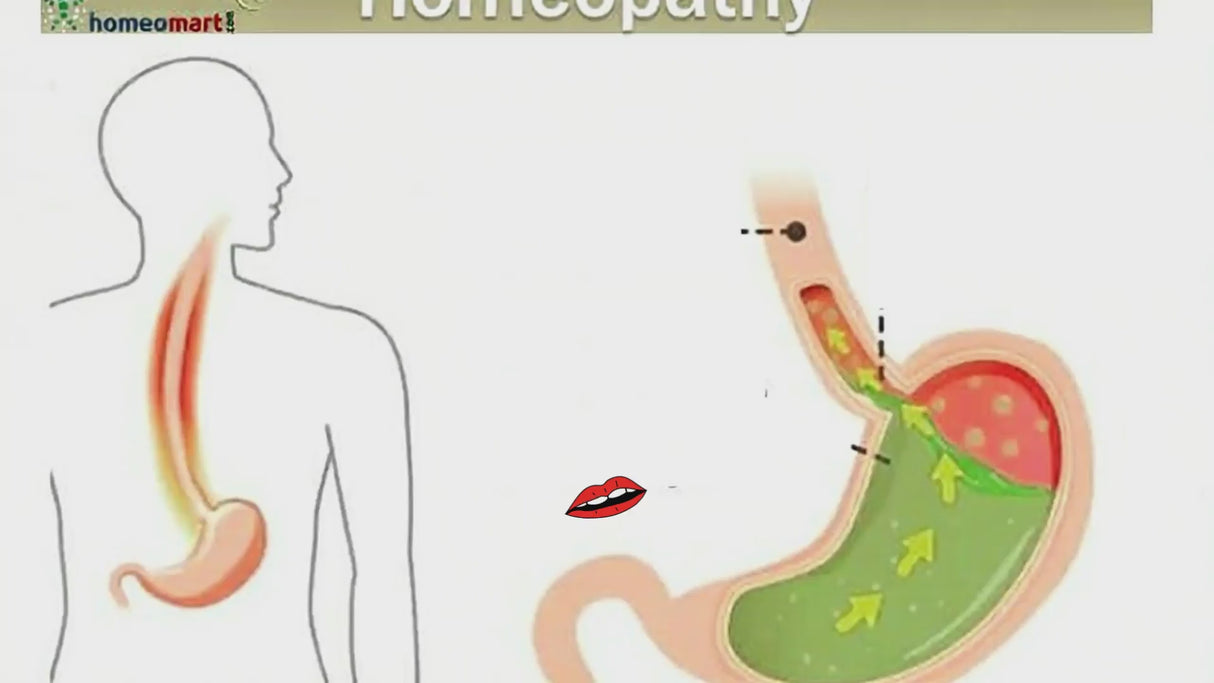homeopathy medicines for digestion problems including acidity, gas, bloating, heartburn & indigestion
