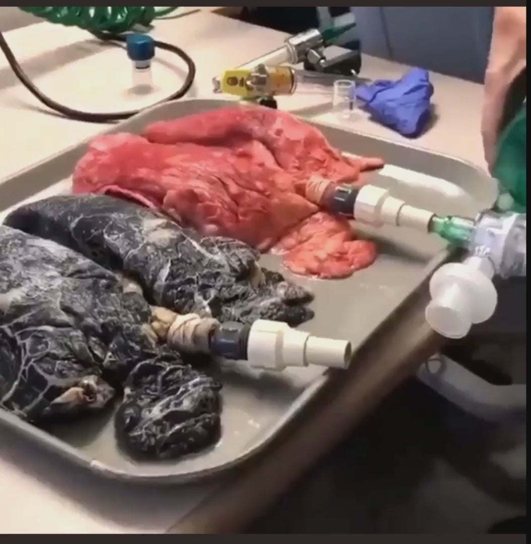 21 second video showing ill effects of smoking with homeopathy anti tobacco remedies