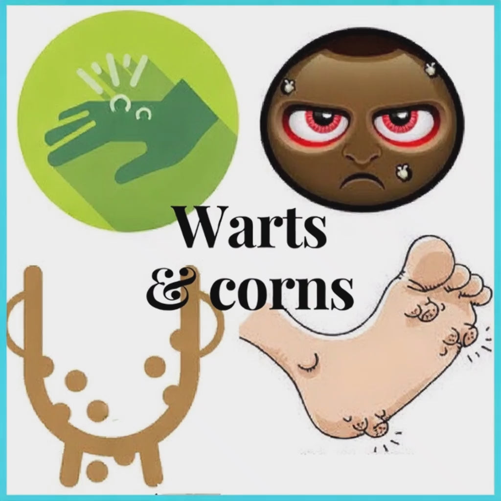 Medisynth Wartex Pills - Natural Remedy for Warts and Corns