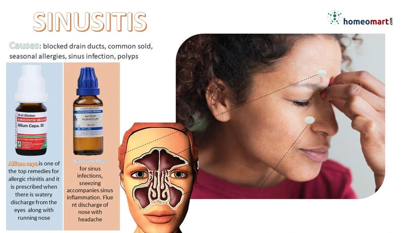Illustration of sinusitis symptoms and treatment with a woman  suffering sinusitis symtoms like nasal blockage and headache