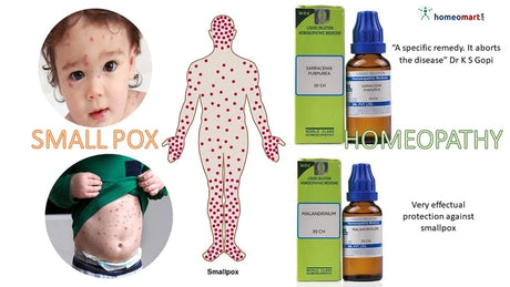 Homeopathy treatment for smallpox with images of a child, body diagram, and homeopathic medicines.