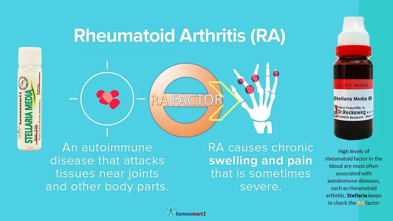 homeopathy medicine  target inflammation, stiffness, and swelling in rheumatoid arthritis