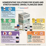 best homeopathic medicine for stretch marks, stretch marks after pregnancy treatment, homeopathic scar removal medicine, medicine for old stretch marks, white stretch marks homeopathy, red stretch marks treatment, pregnancy marks removal naturally,