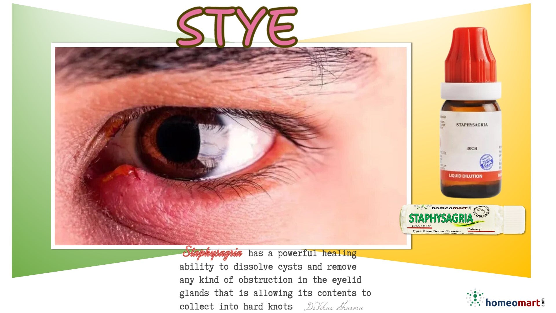 Stye Romycin Dr. advised Stye (hordeolum) infection treatment in homeopathy – Homeomart