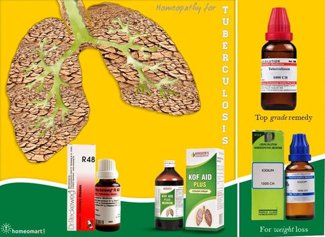 natural tuberculosis treatment without side effects