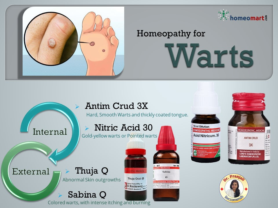 oral medication for warts homeopathic