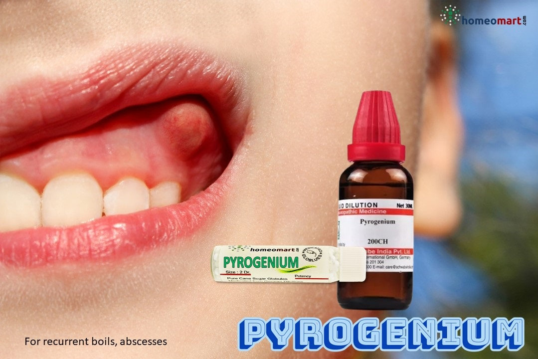 Recurrent boils treatment homeopathy medicine pyrogenium