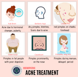 Acne treatment at home