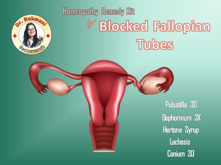 Homeopathy Pills to unblock fallopian tubes