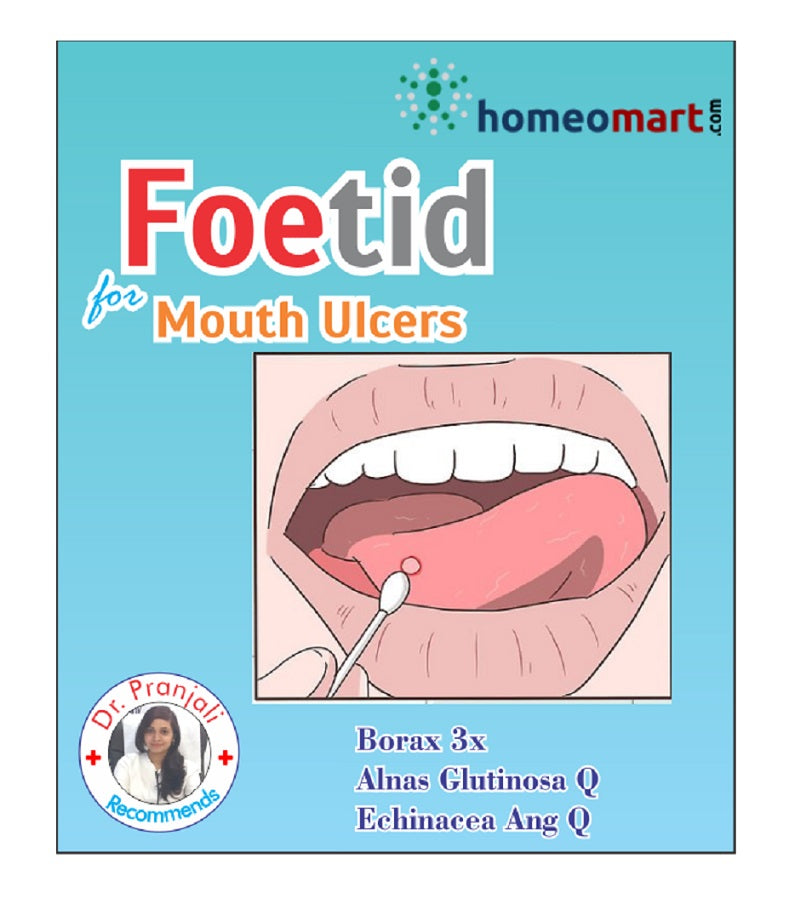 Foetid homeopathy medicine kit for mouth ulcers