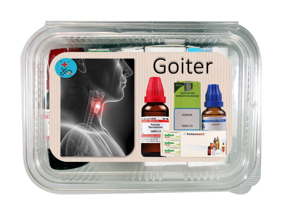 Goiter treatment homeopathy medicines