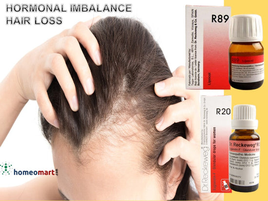 hormone imbalance hair loss treatment with R89 & R20 in women