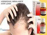 hormone imbalance hair loss treatment with R89 & R20 in women