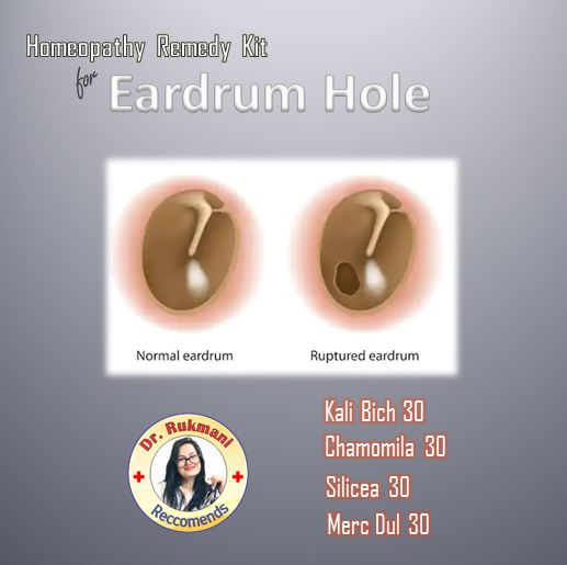 eardrum hole repair without surgery