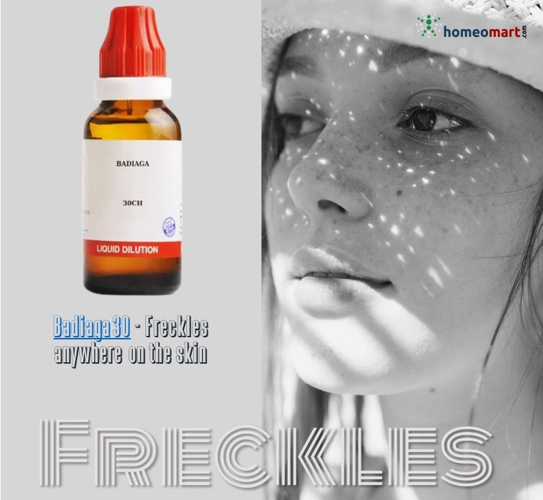 a lady with freckles on face and a bottle of homeopathy