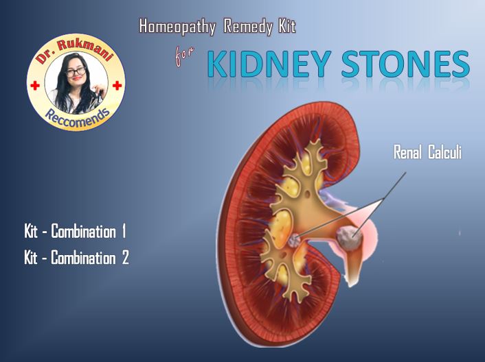 Homeopathy Kidney Stone treatment without surgery  