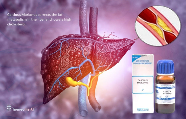 remedy to cleanse Liver  and lower cholesterol in homeopathy