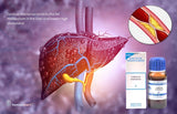 remedy to cleanse Liver  and lower cholesterol in homeopathy