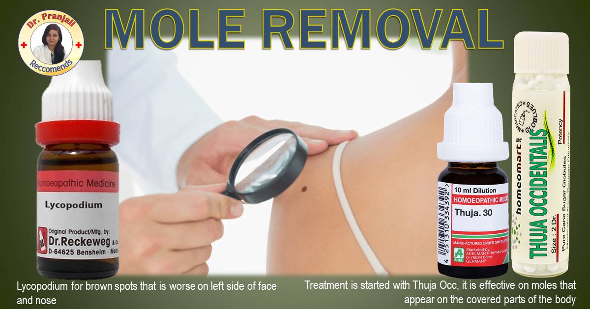 skin mole removal near me