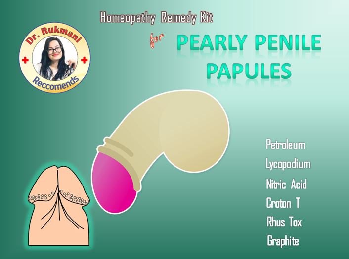 Homeopathy Pearly Penile Papules treatment homeopathy kit  Label