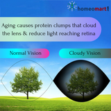 Normal eye and cataract eye images