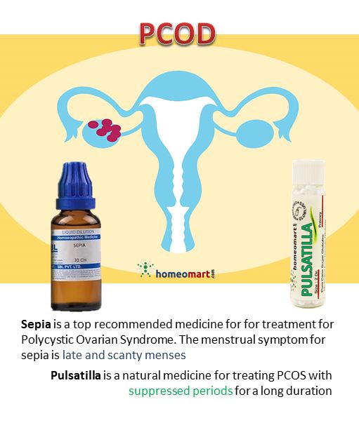 Proven doctore recommended Homeopathic Remedies for PCOS Relief