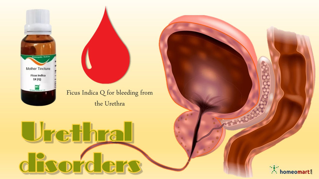 Urethral bleeding treatment homeopathy medicine ficus Indica