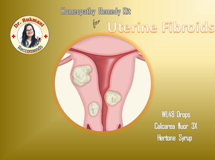 Dr.Rukmani recommended Homeopathy Uterine Fibroids treatment homeopathy kit