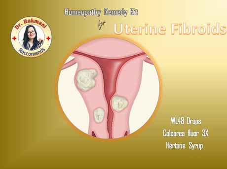 Dr.Rukmani recommended Homeopathy Uterine Fibroids treatment homeopathy kit