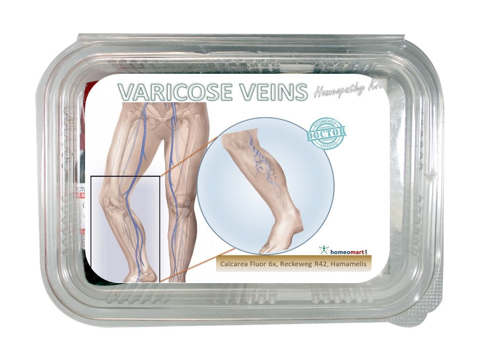 Best treatment for varicose veins 2022