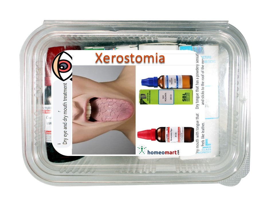 Dry Mouth Xerostomia Homeopathy Remedies